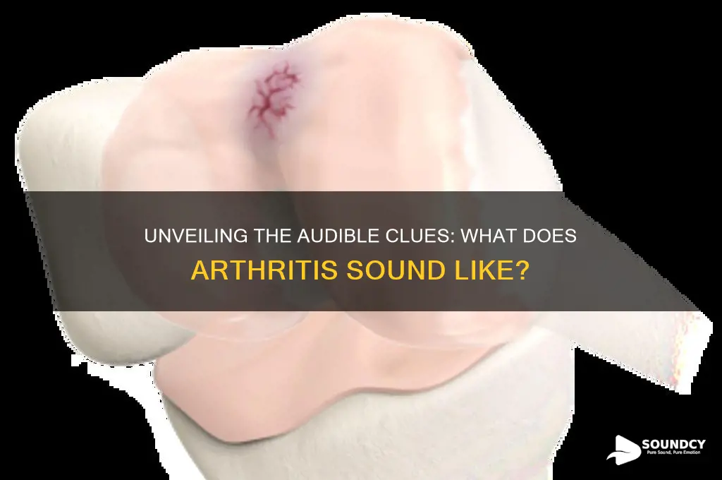 what does arthritis sound like