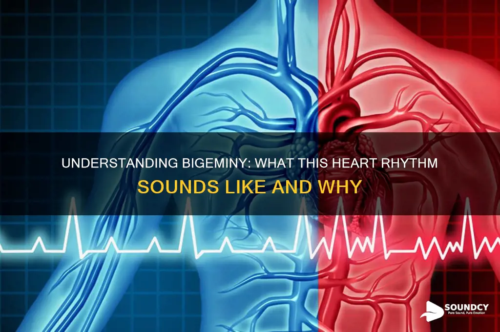 what does bigeminy sound like