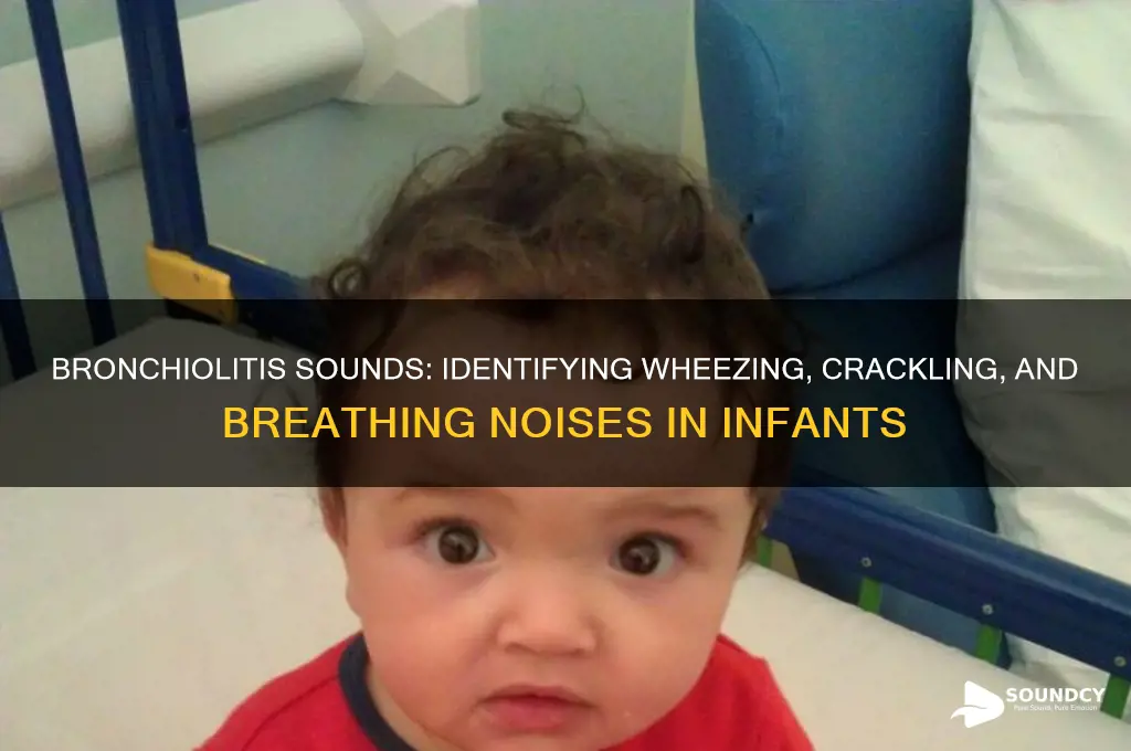 what does bronchiolitis sound like