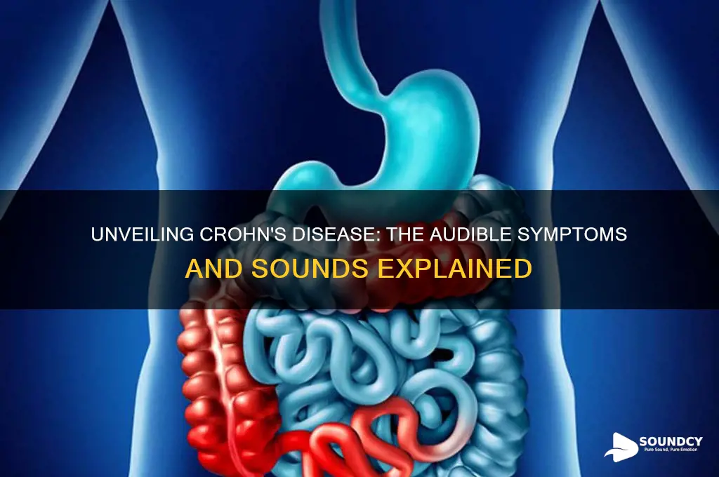 what does crohns sound like