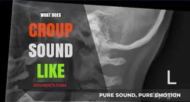 Understanding Croup: Identifying the Distinctive Barking Cough and Stridor Sound