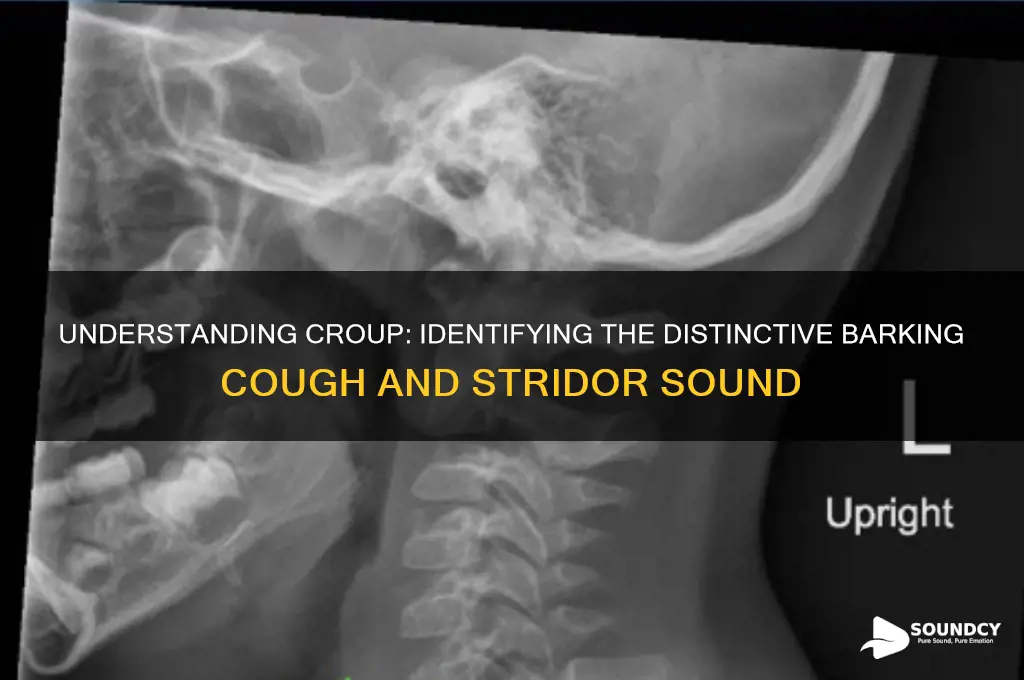 what does croup sound like