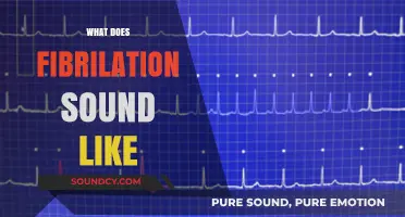 Understanding Fibrillation: What Does This Irregular Heartbeat Sound Like?