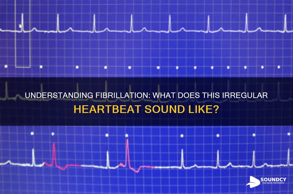 what does fibrilation sound like