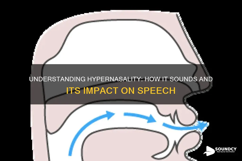 what does hypernasality sound like