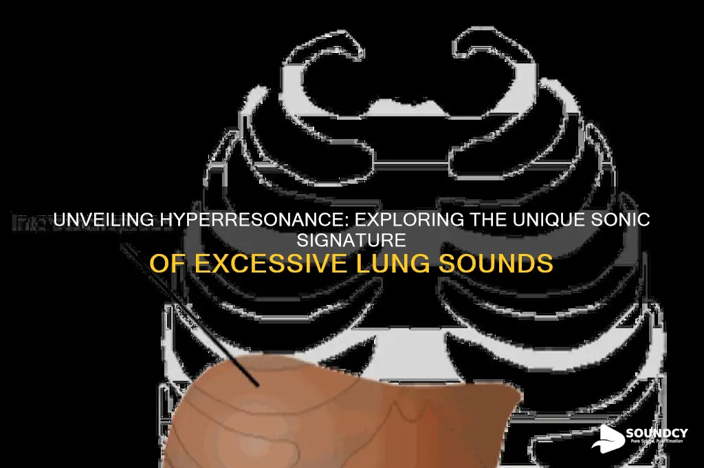 what does hyperresonance sound like
