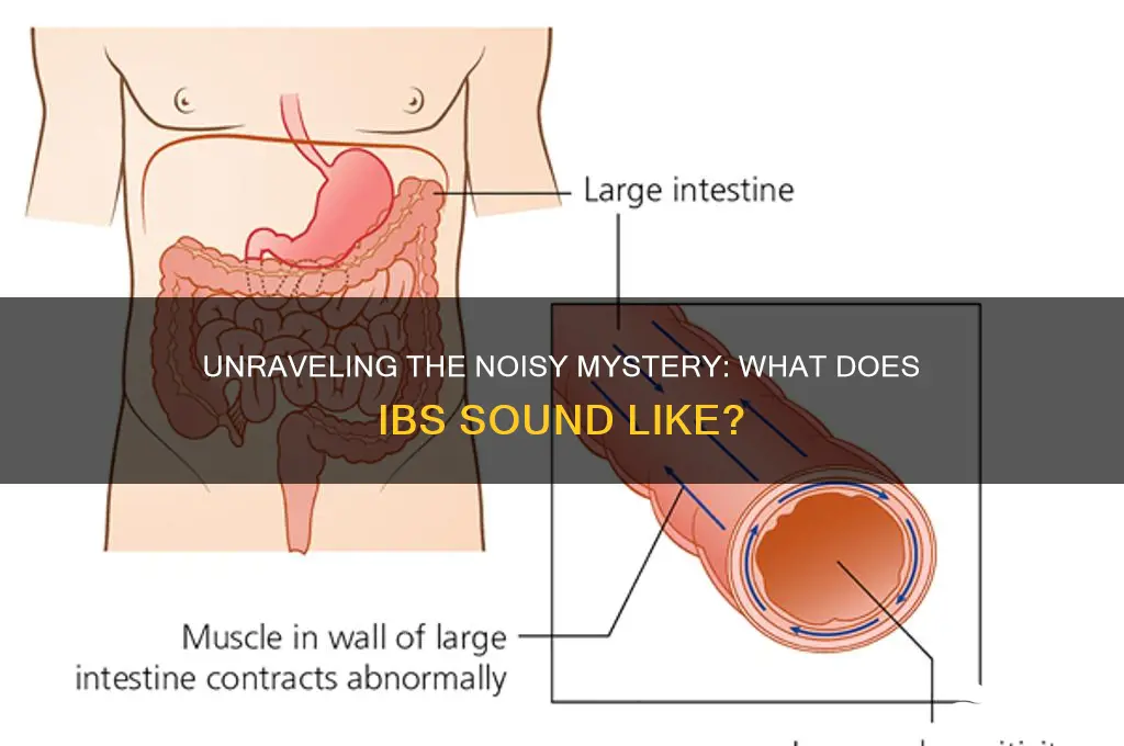 what does ibs sound like