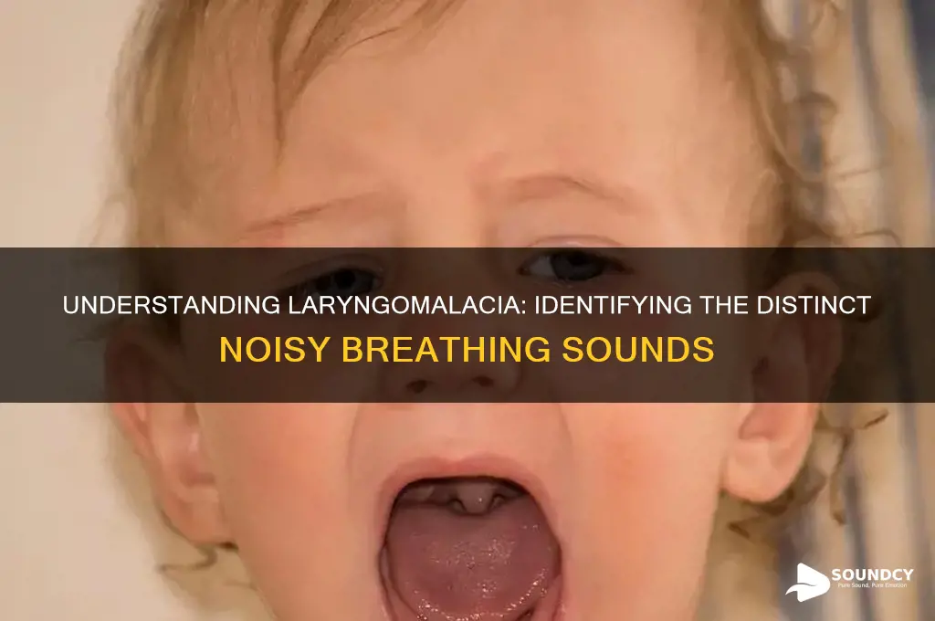 what does laryngomalacia sound like