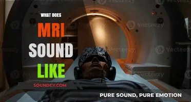Unveiling the Noisy Mystery: What Does an MRI Sound Like?