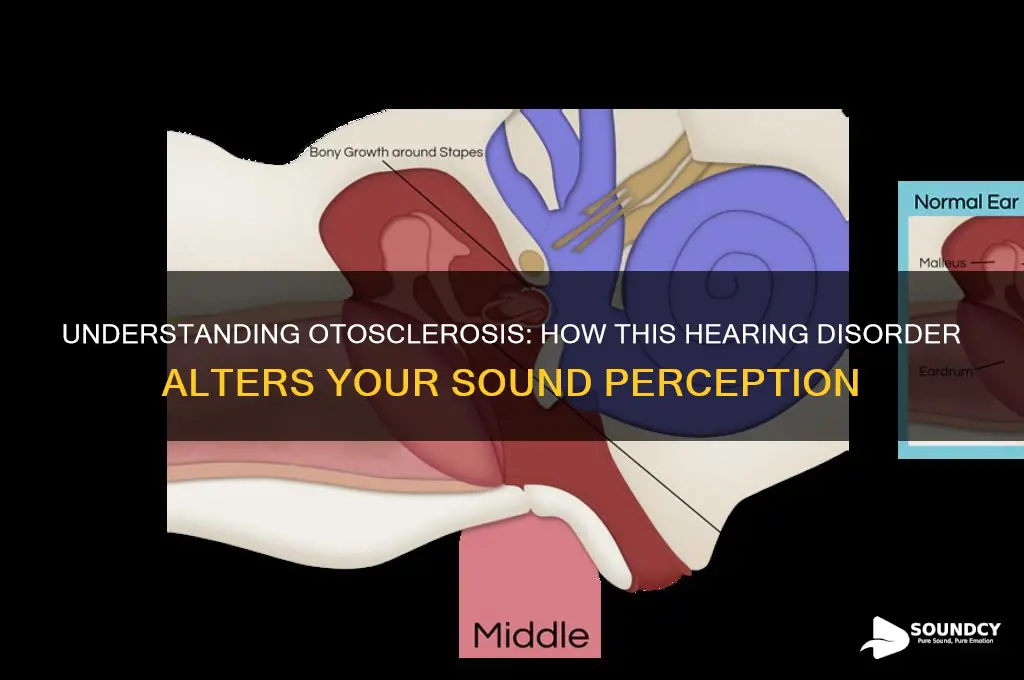 what does otosclerosis sound like