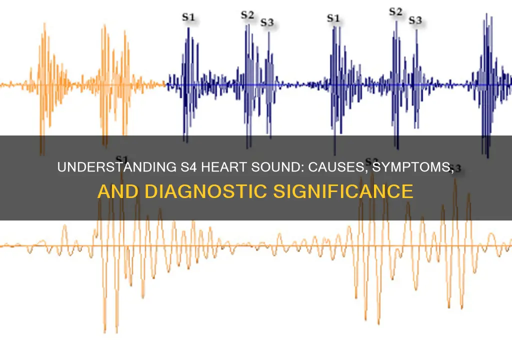 what does s4 sound indicate