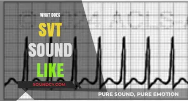 Understanding SVT: What Supraventricular Tachycardia Sounds Like in Detail