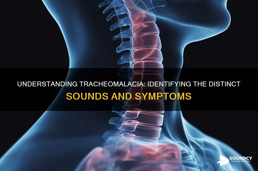 what does tracheomalacia sound like