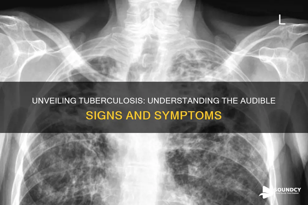 what does tuberculosis sound like
