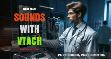 Understanding Heart Sounds in VTach: A Comprehensive Guide for Clinicians