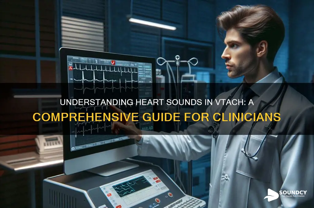 what heart sounds with vtach