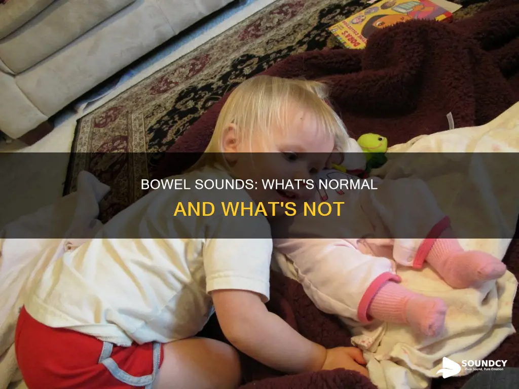 what is a normal bowel sound