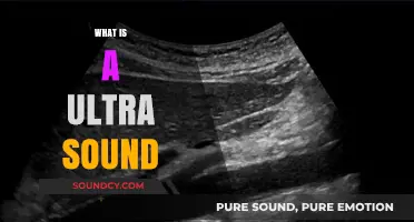 Understanding Ultrasound: A Comprehensive Guide to This Medical Imaging Technique