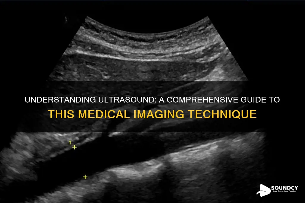 what is a ultra sound