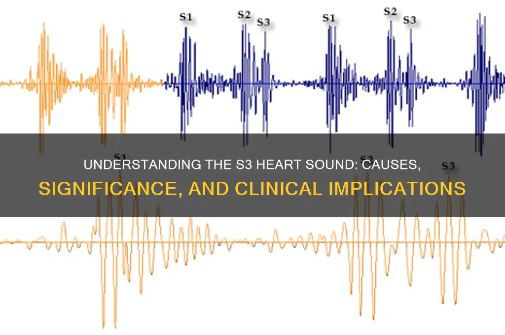 what is an s3 sound