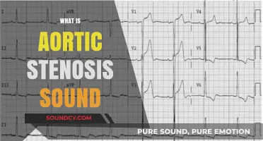Understanding the Distinct Murmur of Aortic Stenosis: A Comprehensive Guide