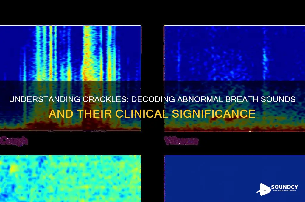 what is crackles breath sound
