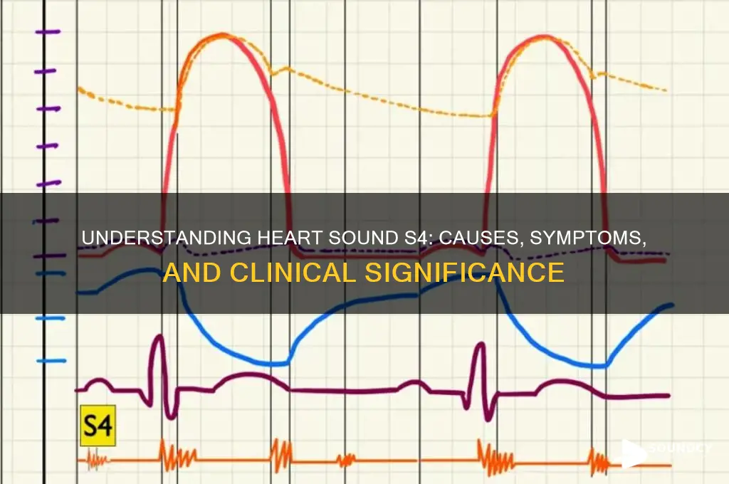 what is heart sound s4