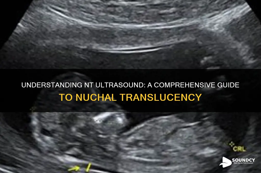 what is nt ultra sound