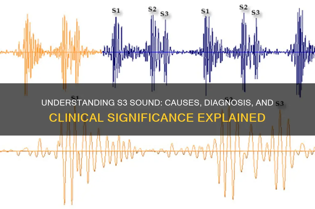 what is s3 sound by