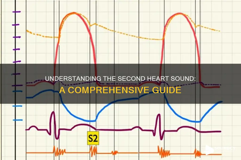 what is second heart sound