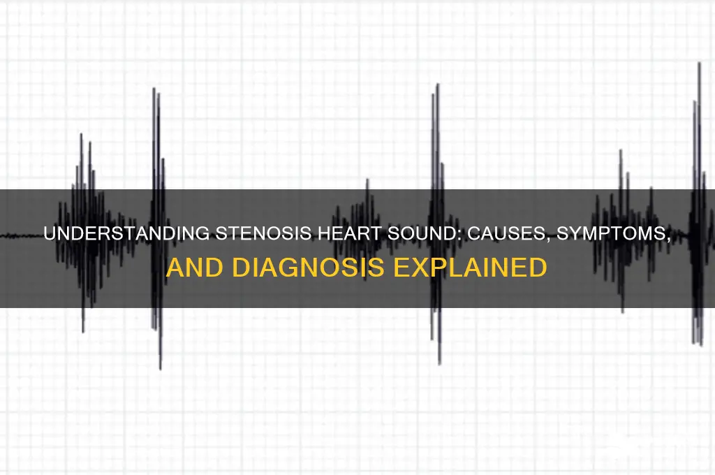 what is stenosis heart sound
