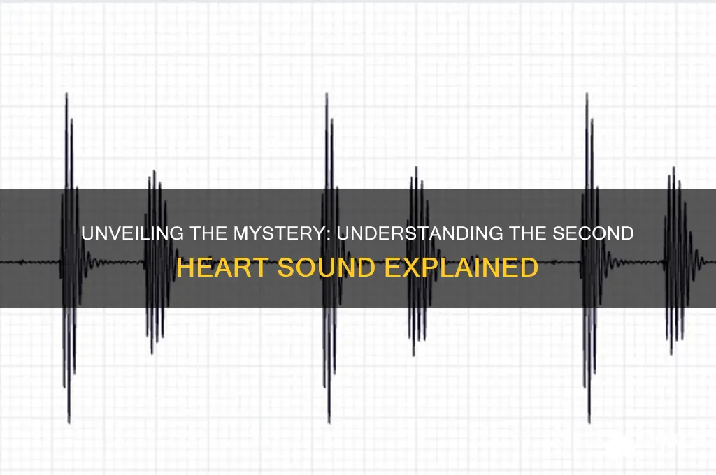 what is the second sound