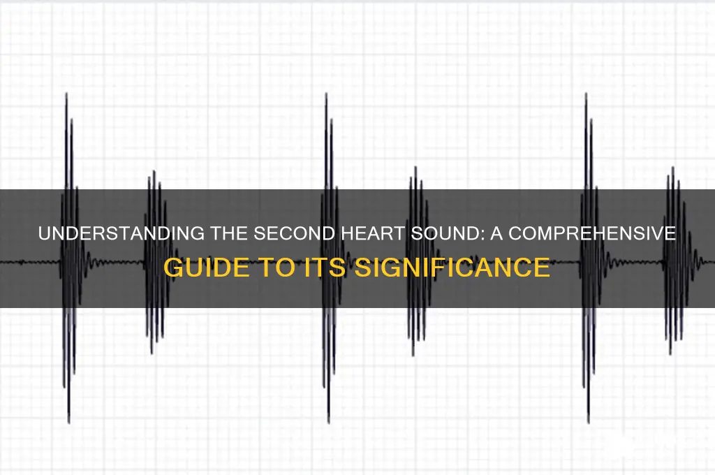 what is the secondheart sound