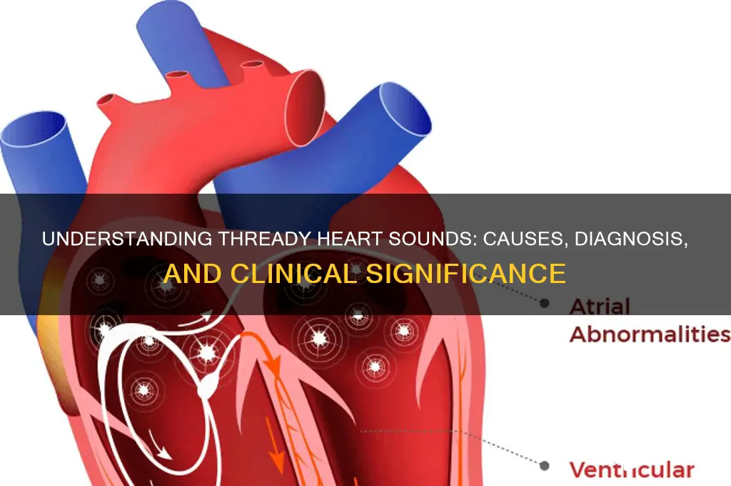 what is thready heart sounds
