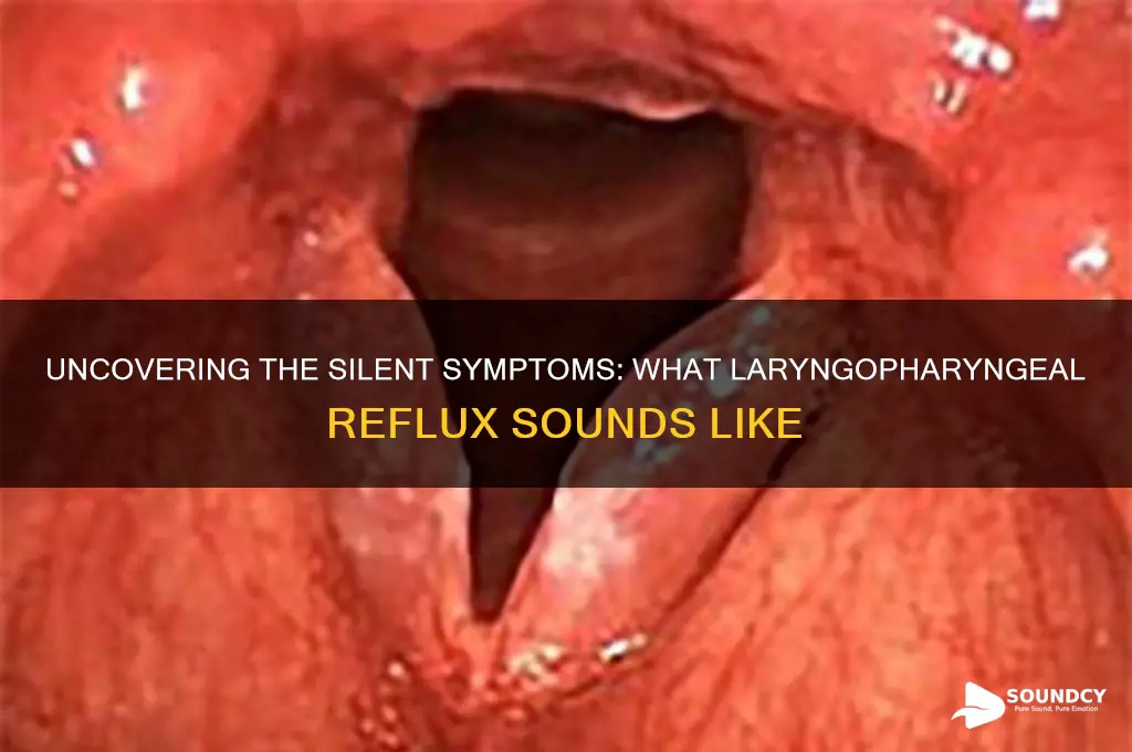 what laryngopharyngeal reflux sounds like