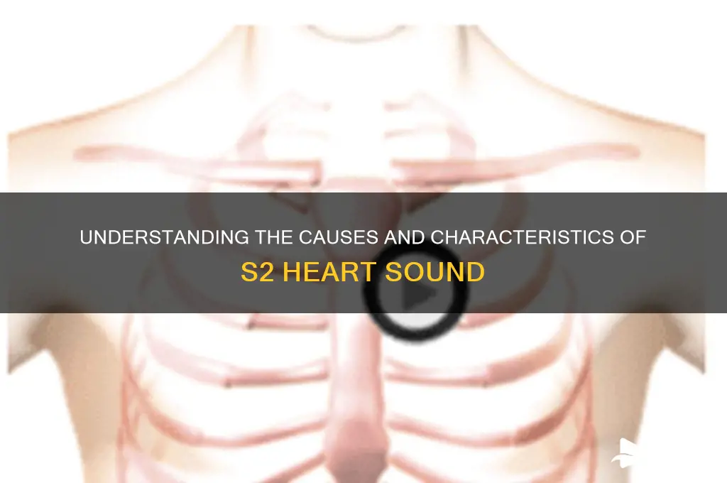 what makes s2 heart sound