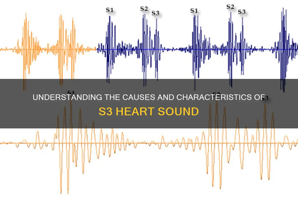 what makes s3 heart sound