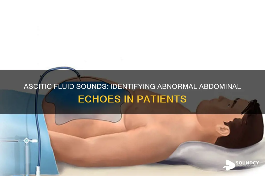 what sound suggests ascitic fluid