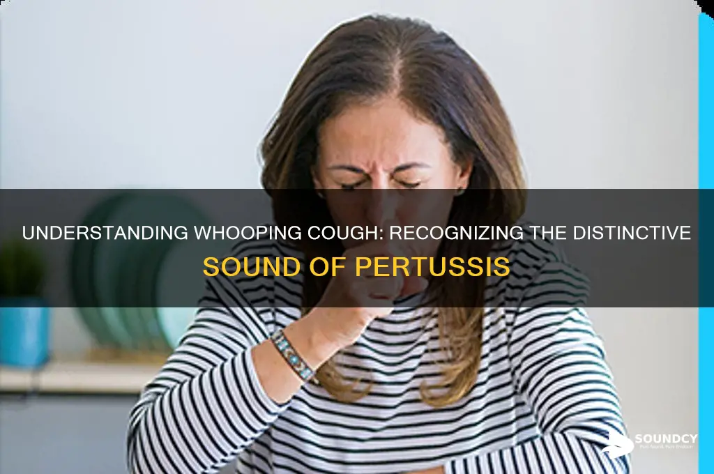 what whooping cough sounds like