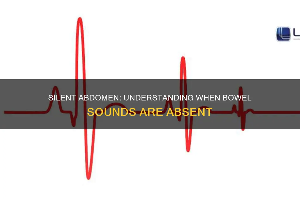 when are bowel sounds absent