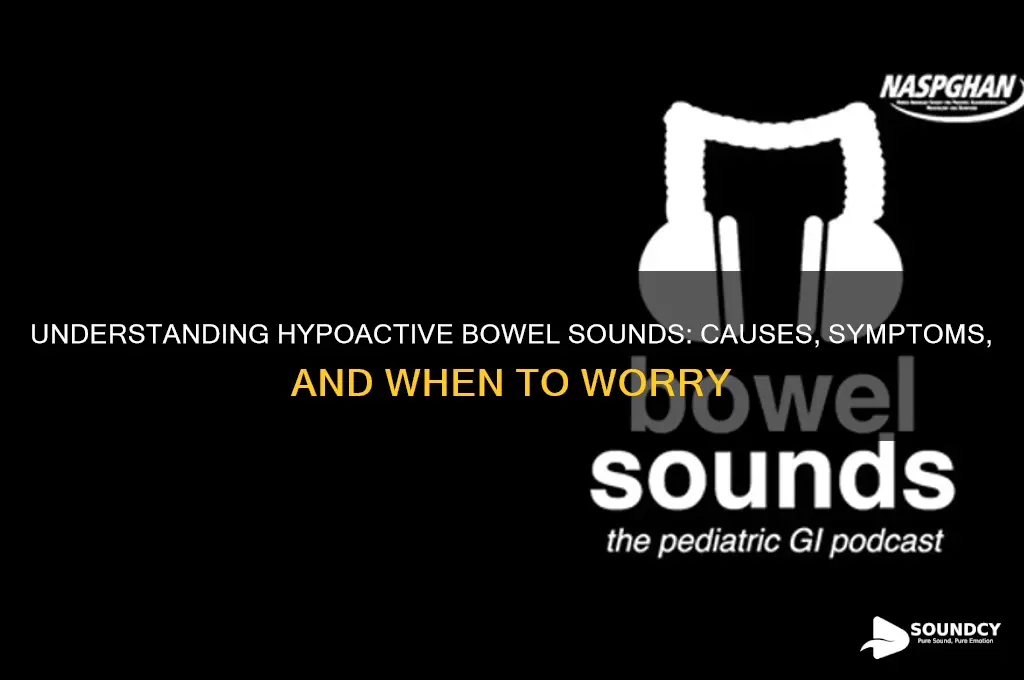 when are bowel sounds hypoactive