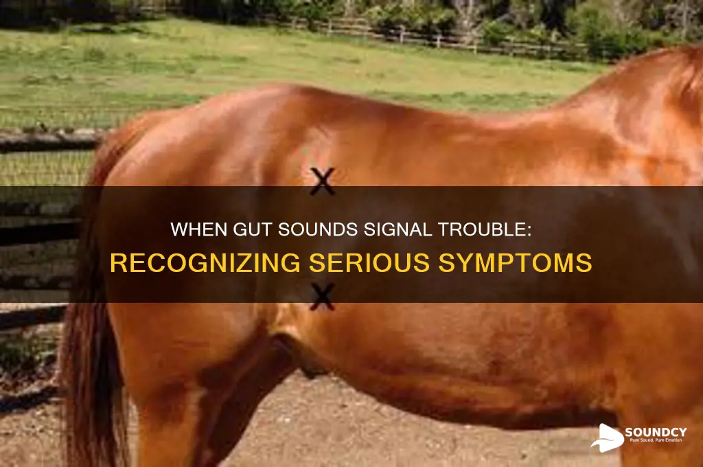 when are gut sounds serious
