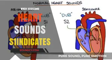 Understanding Heart Sounds: What S1 Indicates in Cardiac Assessment