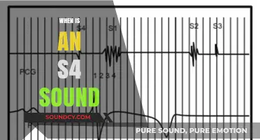 Understanding the S4 Heart Sound: Timing, Causes, and Clinical Significance