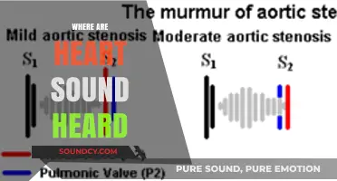 Heart Sound Listening Guide: Where to Hear Cardiac Murmurs Clearly