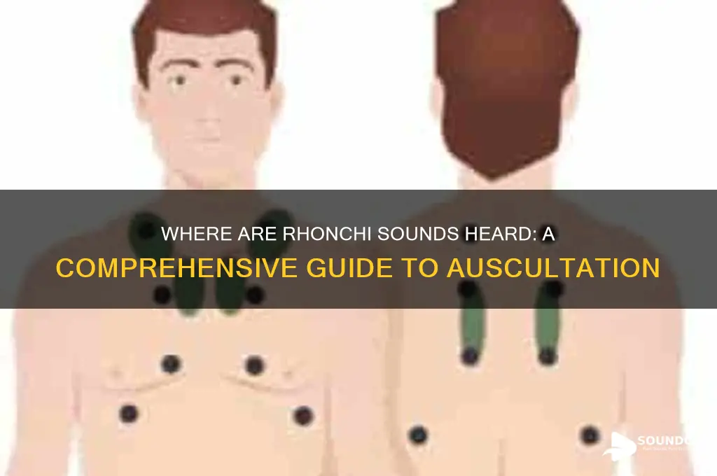 where are rhonchi sounds heard