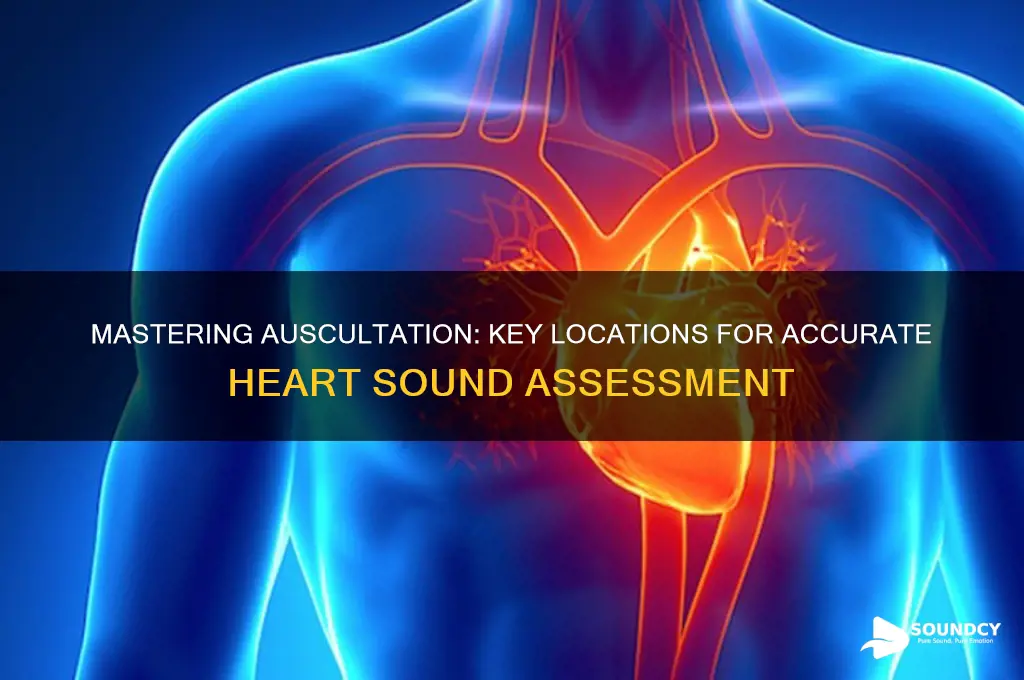where to auscultate heart sounds