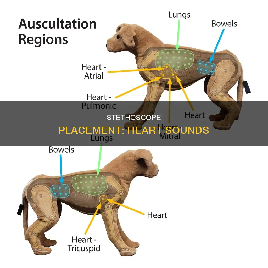 where to listen for heart sounds
